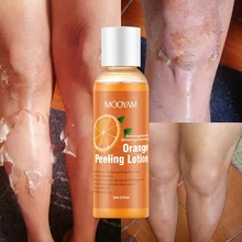 Foot Peeling Lotion Bleaching Dark Skin Spots Blackheads Blemishes Bad Skin Spot Treatment Whitening Peeling Lotion