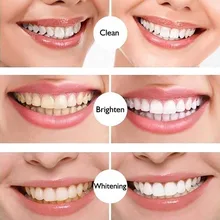 Teeth Whitening Pen Tooth Gel Whitener Bleach Remove Stains Oral Hygiene Cleaning Gel Fresh Breath Whiten Teeth Cleaning Serum
