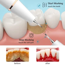 Ultrasonic Dental Scaler For Teeth Tartar Stain Electric Sonic Dental Cleaning USB Portable Oral Irrigator Dental Stone Removal
